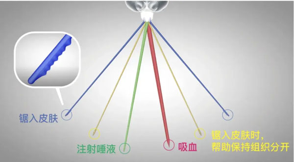 蚊子的嘴